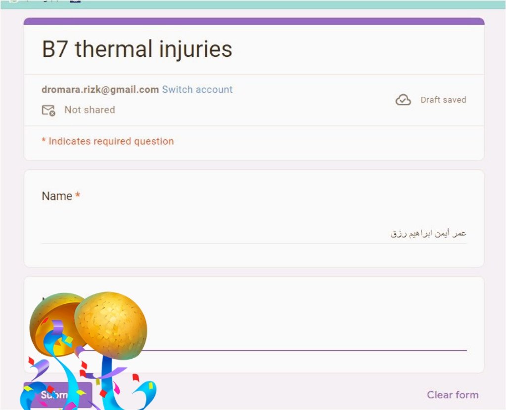 اللهم لك الحمد آخر سكشن أونلاين وآخر سكشن في الحياة الدراسية عموماً 🥳
كانت أعواماً مليئة ب"المايك بيعلق يا دكتور- الفورم مبيفتحش- الصوت بيقطع- وأشياء أخرى"