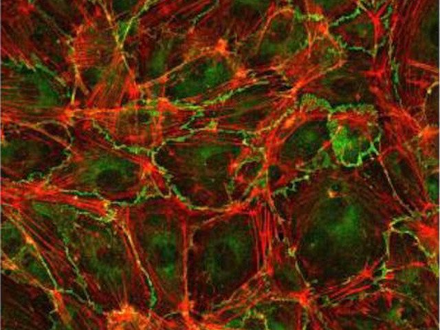 Biomedical Picture of the Day BPoD tweet media