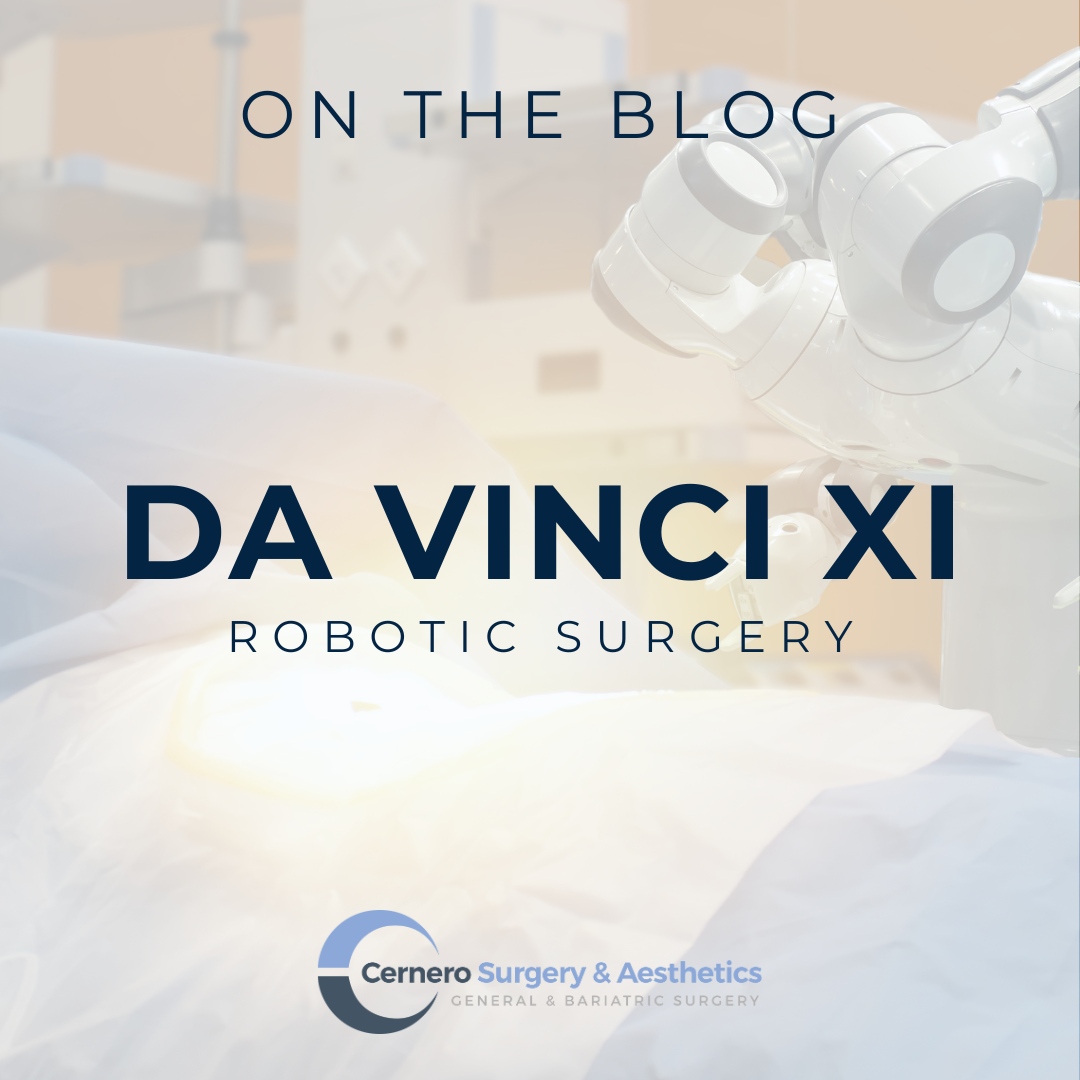 CerneroSurgery's tweet photo. The Da Vinci XI robotic system stands out as a beacon of modern surgery, vastly improving techniques and outcomes. If you need surgery but are hesitant about the process or recovery, robotic surgery could be an option. Learn more in our latest blog: https://t.co/GNOhELosSW https://t.co/4PLks5s4a6