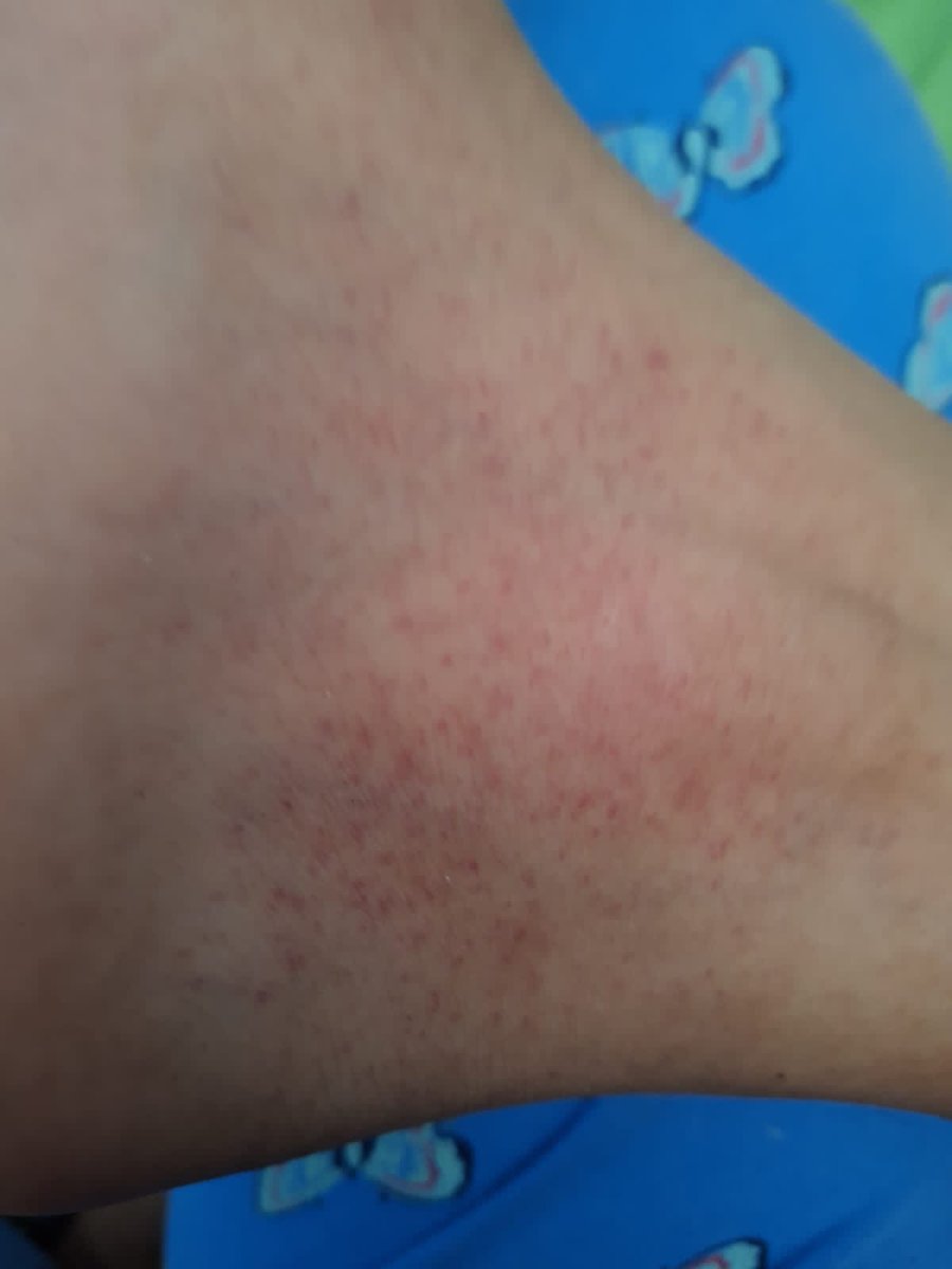 njro22's tweet photo. @ISSS_Atento @isss_gob_sv Ahí tienen la infección en vías urinarias qué tengo. Que les importa más platicar de que van a comer en vez de ayudar a la gente. Mi pareja salio el día miércoles a las 230 am y le dijeron que era infección también ahora esta gravemente en otra clinica https://t.co/ChDoRtktaN