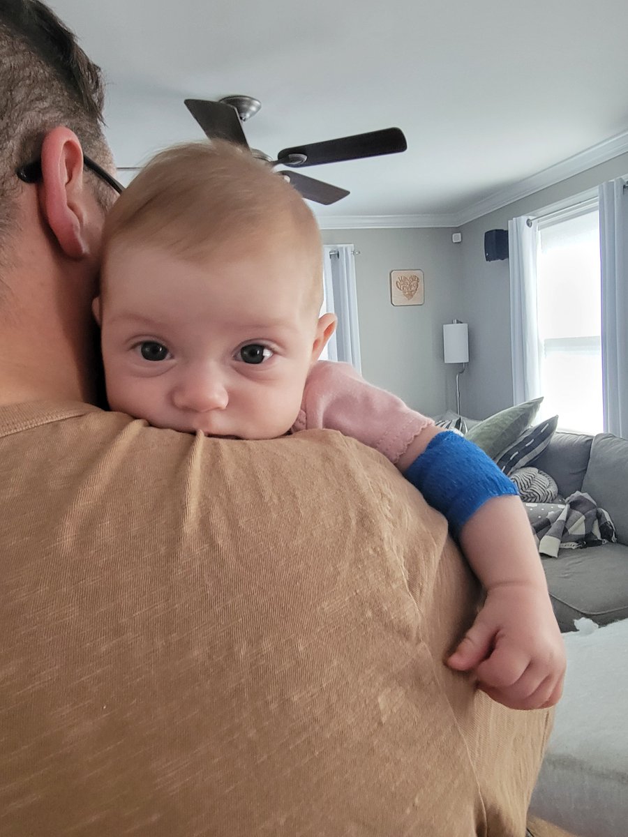 NAFOteacher's tweet photo. Unfortunately, Delilah dropped to the 2nd percentile in weight. She's gaining but far too slowly. The doctor is concerned and ordered blood work which we just had done 🥺 & gave us stool test kits to see if she needs an amino acid formula. I'm just so overwhelmed. Life's been a bit of a nightmare between this & my retinal detachment which still has me in a panic since I'm living with one blurry eye. What a rough 3 months 😭