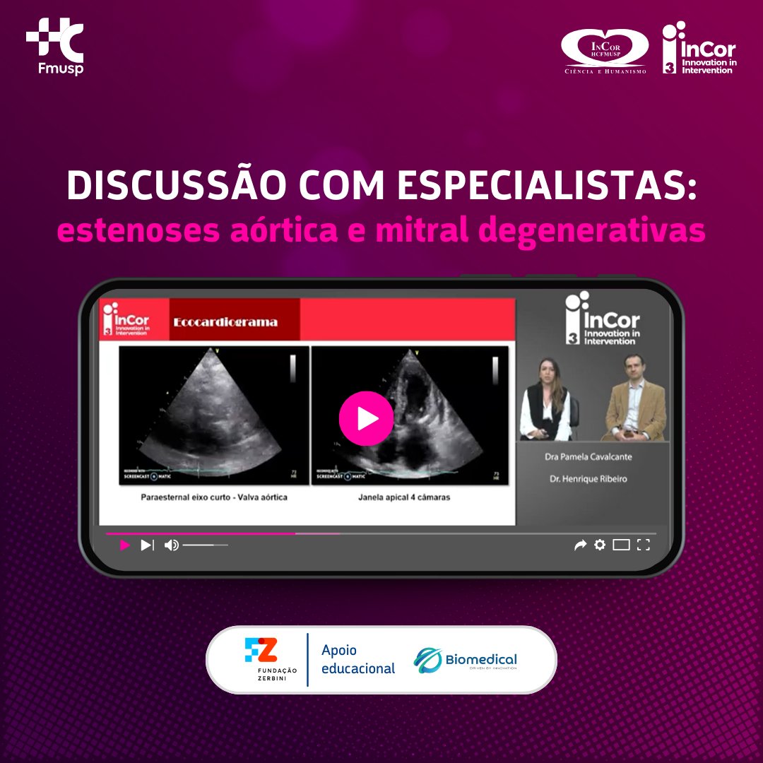 3i_incor's tweet photo. Vamos rever essa discussão com especialistas?
Dra. Pamela Cavalcante e Dr. Henrique Ribeiro apresentam um #casoclínico de uma paciente com #estenoseaórtica e mitral importante degenerativa. Venha conferir: https://t.co/ORxrjfTHAF https://t.co/63ByTXyO3x