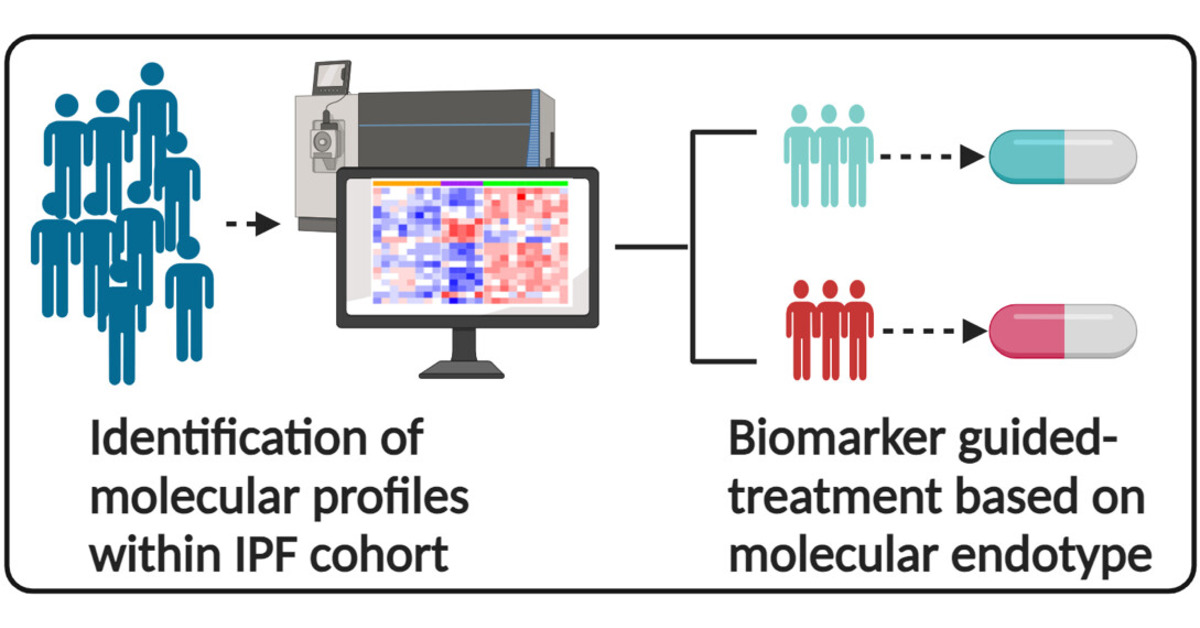 ATS Blue Journal (@atsblueeditor) on Twitter photo Decoding Molecular Heterogeneity in Idiopathic Pulmonary Fibrosis
<a href="/atscommunity/">American Thoracic Society (ATS)</a>
š tinyurl.com/mrxsex27 Decoding Molecular Heterogeneity in Idiopathic Pulmonary Fibrosis
<a href="/atscommunity/">American Thoracic Society (ATS)</a>
š tinyurl.com/mrxsex27