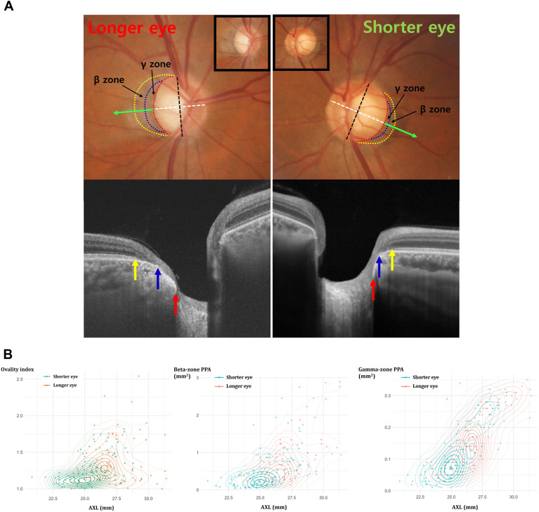 Ophthalmology tweet media