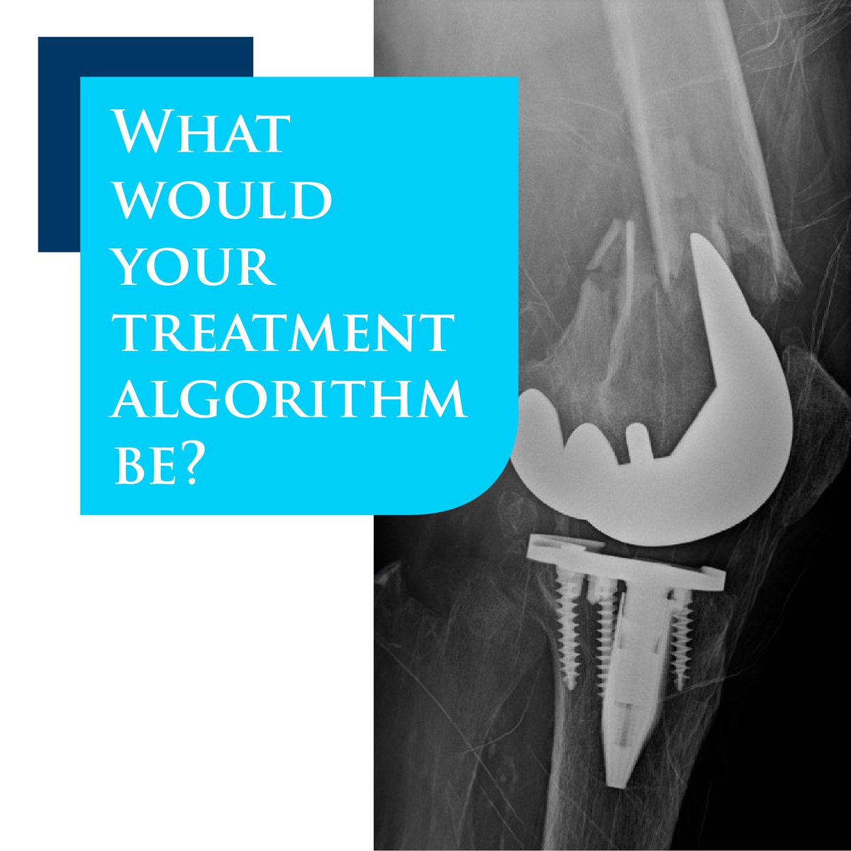 IlluminOss Medical tweet media