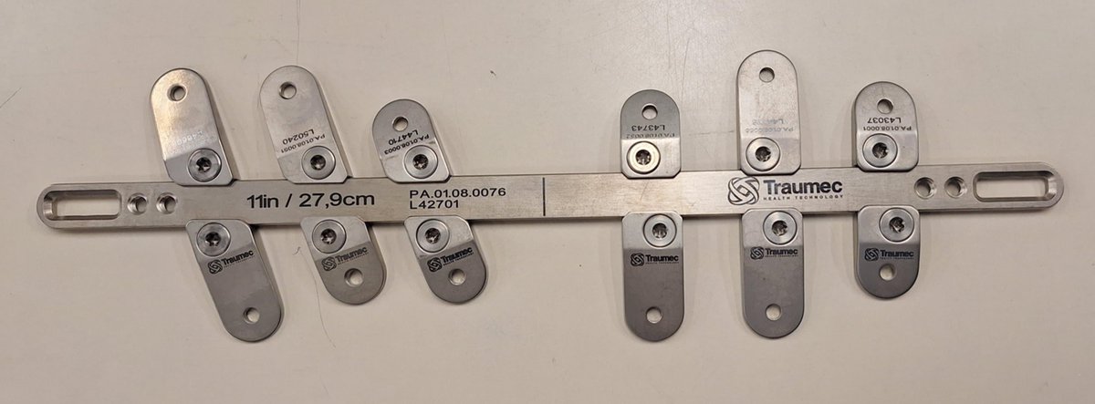 pjctvs's tweet photo. (5/6) 🏁 This case reinforces the validity of late radiological follow-up after MIRPE in an attempt to avoid this type of event, and the need to reevaluate the use of stabilizers perpendicular to the bar since they are not safe to prevent rotation of these implants. https://t.co/fxMV1Uzy1P
