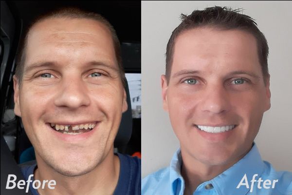 dentalimplants's tweet photo. G4 is now offering EZ Qualify financing👍 - https://t.co/WW0px1f2Vr https://t.co/PG7UoqgXhN