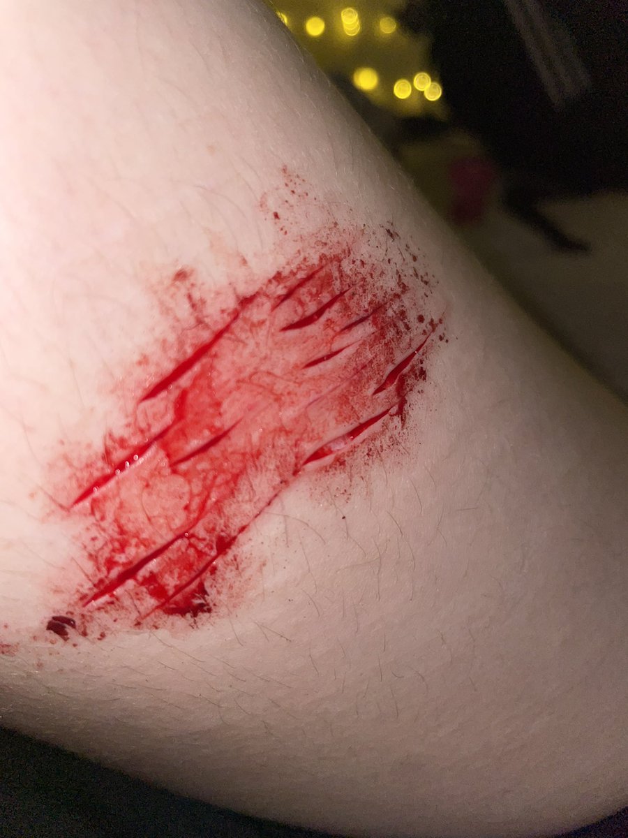 ang3lrexic's tweet photo. L and R thigh aftermath yay!! (Ps how do I clean this help..) https://t.co/DhVm1mU68X