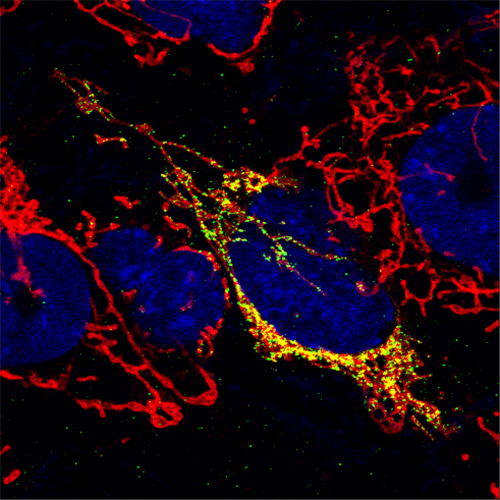 CWRUSOM's tweet photo. Decades of groundbreaking research in the pathophysiology of mitochondria and partnerships with an expanding group of area researchers have fueled the creation of @cwru School of Medicine’s Center for Mitochondrial Research and Therapeutics.  https://t.co/1bQROkIzst https://t.co/CpQs8llR47