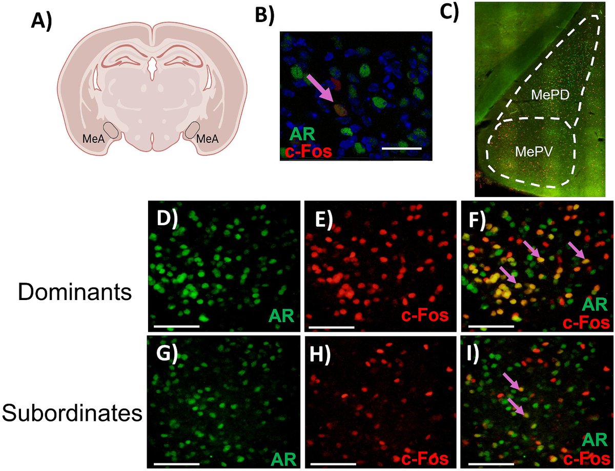HormBehav's tweet image. &quot;Activation of androgen receptor-expressing neurons in the posterior medial amygdala is associated with stress resistance in dominant male hamsters&quot;

🧠 AR activation ⬆️  correlates with proactive coping in dominant  ♂️ 🐹

by @BrainBehavTalk et al.

tinyurl.com/55t67m8x