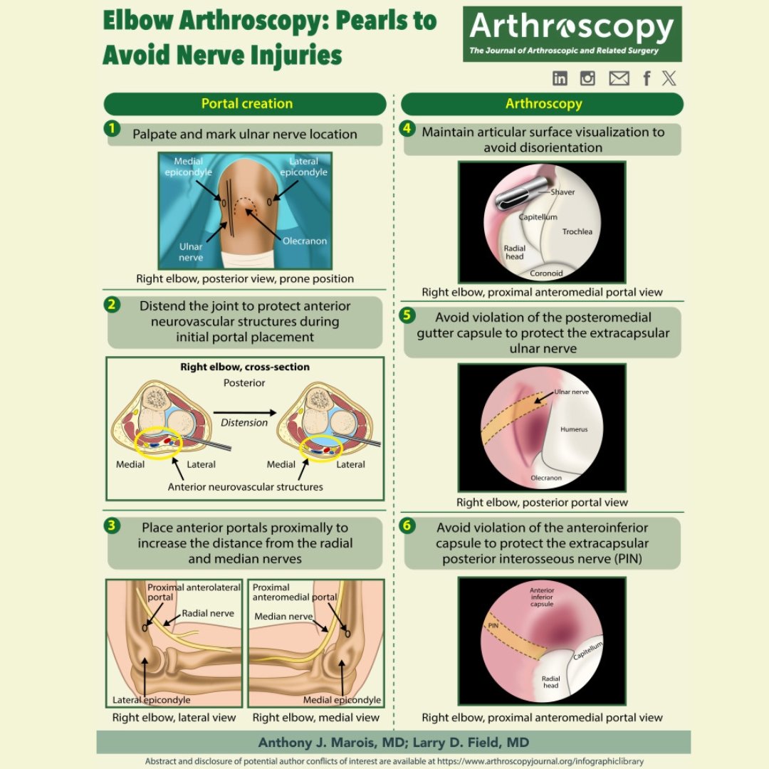 Check out our latest infographic on elbow arthroscopy pearls to avoid nerve injuries.  #ElbowArthroscopy #SurgicalPearls #OrthopedicInsights
ow.ly/G3pA50SZZr9