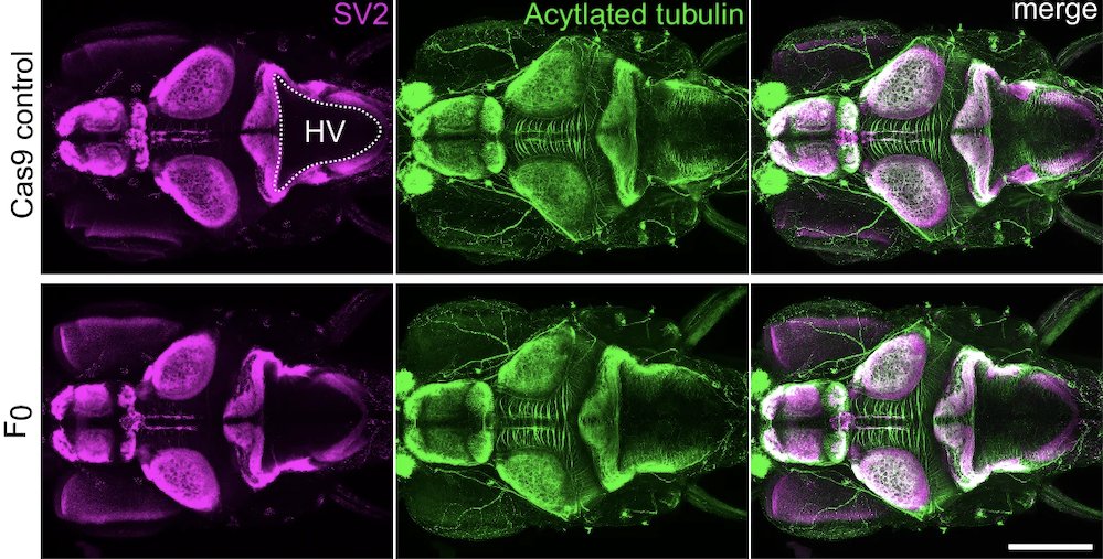 Gaurav Varshney (@varshneylab) on Twitter photo Our collaborative paper on understanding the role of DENND5A gene in brain development and its link to Developmental and Epileptic Encephalopathy (DEE) is now online in <a href="/NatureComms/">Nature Communications</a>. nature.com/articles/s4146…
Emily Banks led this project from Peter McPherson's lab Our collaborative paper on understanding the role of DENND5A gene in brain development and its link to Developmental and Epileptic Encephalopathy (DEE) is now online in <a href="/NatureComms/">Nature Communications</a>. nature.com/articles/s4146…
Emily Banks led this project from Peter McPherson's lab