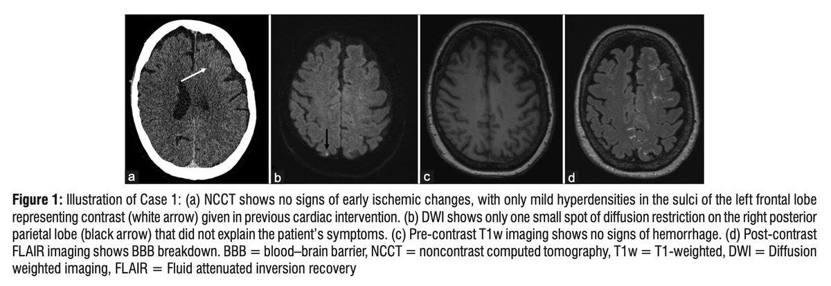 Johanna Ospel, MD PhD tweet media