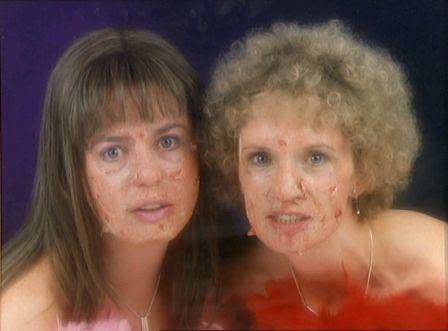 Jubbb's tweet image. Booked a chemical peel