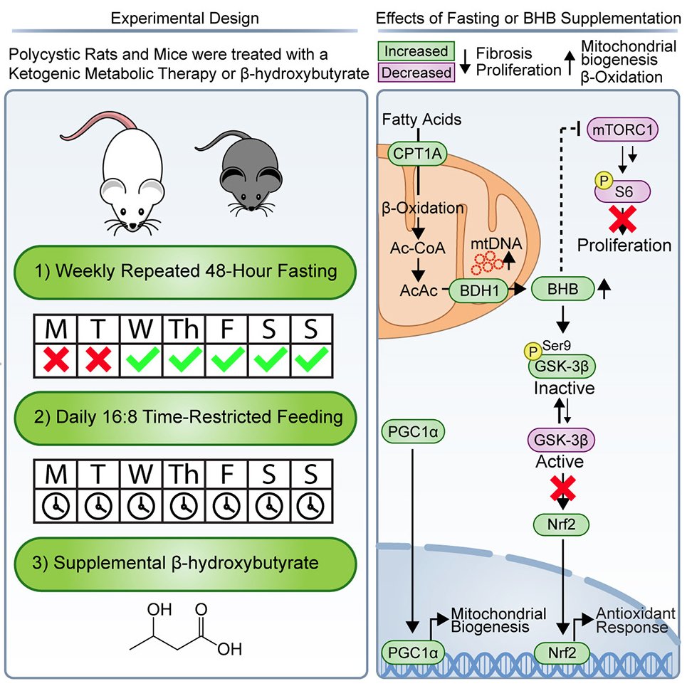 β-Hydroxybutyrate Recapitulates the Beneficial Effects of Ketogenic Metabolic Therapy in Polycystic Kidney Disease

Our newest paper was just published in iScience: doi.org/10.1016/j.isci…