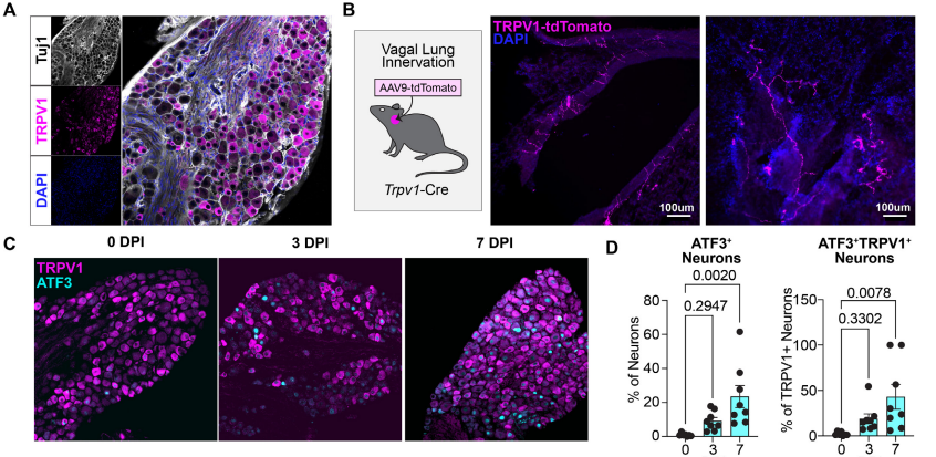 LabWaggoner's tweet photo. Vagal TRPV1+ sensory neurons regulate myeloid cell dynamics and protect against influenza virus infection
@IsaacMChiu @pbaral14 @haber_lab_hsph @DapingYang88
https://t.co/z7rKzYy1MJ https://t.co/OvNRI8E4Tw