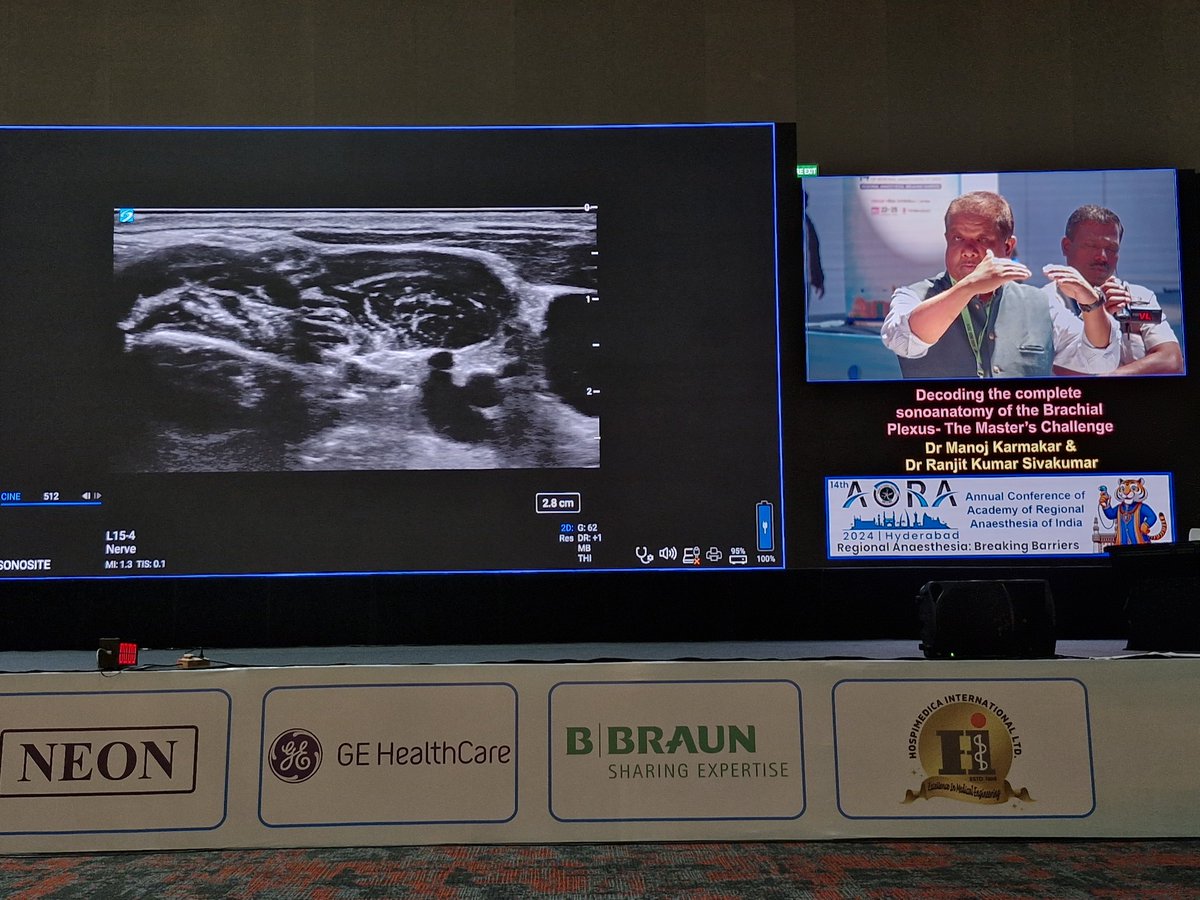 Divesh Arora (@drdivesharora) on Twitter photo #AORA24
Professor Karmakar and <a href="/Sivakumar_SRK/">Ranjith K Sivakumar</a> starting the day 1 of RA conclave of 🇮🇳 with the master demo on SUIT technique for scanning brachial plexus..
rapm.bmj.com/content/46/12/…
<a href="/KalagaraHari/">🩺 Hari (హరి 🇮🇳) Kalagara</a> <a href="/MadanNarayanan/">MadanKumar Narayanan</a> <a href="/BalavenkatSubr1/">Balavenkat Subramanian</a> <a href="/vrushali_ponde/">Vrushali Ponde</a> <a href="/pritanand/">Dr Prit Anand Singh</a> <a href="/jeffgadsden/">Jeff Gadsden</a> <a href="/Ropivacaine/">Dr. Vishal Uppal MBBS, FRCA 🇨🇦🇮🇳🏴</a> #AORA24
Professor Karmakar and <a href="/Sivakumar_SRK/">Ranjith K Sivakumar</a> starting the day 1 of RA conclave of 🇮🇳 with the master demo on SUIT technique for scanning brachial plexus..
rapm.bmj.com/content/46/12/…
<a href="/KalagaraHari/">🩺 Hari (హరి 🇮🇳) Kalagara</a> <a href="/MadanNarayanan/">MadanKumar Narayanan</a> <a href="/BalavenkatSubr1/">Balavenkat Subramanian</a> <a href="/vrushali_ponde/">Vrushali Ponde</a> <a href="/pritanand/">Dr Prit Anand Singh</a> <a href="/jeffgadsden/">Jeff Gadsden</a> <a href="/Ropivacaine/">Dr. Vishal Uppal MBBS, FRCA 🇨🇦🇮🇳🏴</a>
