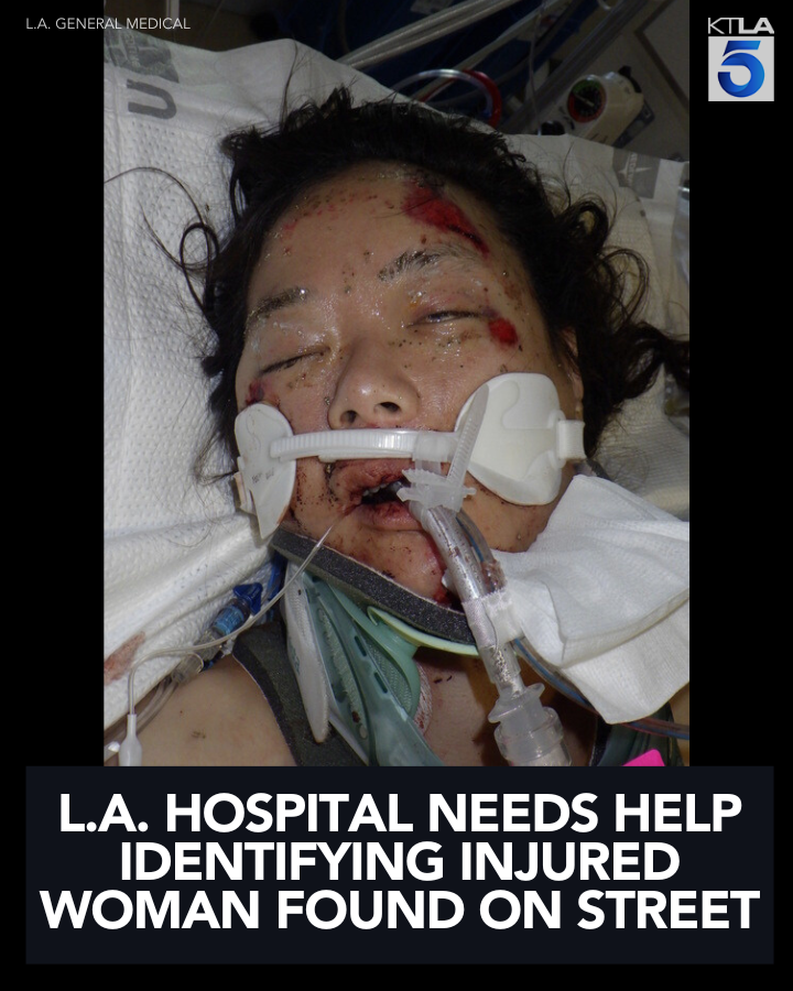 KTLA's tweet photo. A Los Angeles hospital is seeking the public's help to identify a female patient who was found injured on the ground.
Details: https://t.co/YtbnnkZXsv https://t.co/mfw02cxEQ7