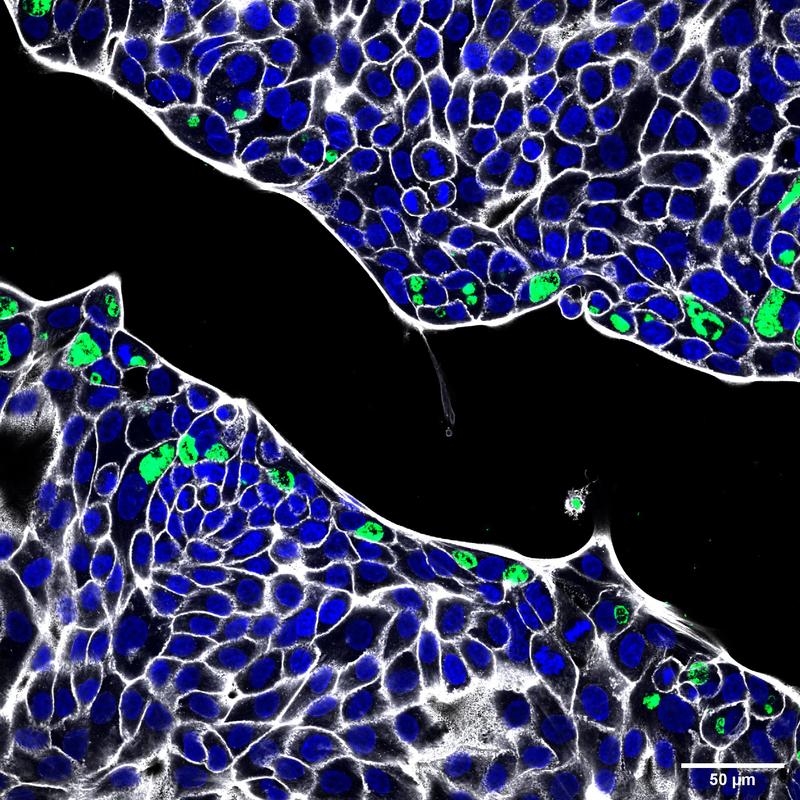 Informationsdienst Wissenschaft - Nachrichten (@idw_online_de) on Twitter photo New paper <a href="/PLOSPathogens/">PLOS Pathogens</a>: Infection of human #organoids supports an intestinal niche for #Chlamydia trachomatis. <a href="/lab_rudel/">Rudel Lab</a> <a href="/Uni_WUE/">Universität Würzburg #UniWürzburg</a> @SinaBartfeld <a href="/TUBerlin/">TU Berlin</a>
nachrichten.idw-online.de/2024/08/23/chl… New paper <a href="/PLOSPathogens/">PLOS Pathogens</a>: Infection of human #organoids supports an intestinal niche for #Chlamydia trachomatis. <a href="/lab_rudel/">Rudel Lab</a> <a href="/Uni_WUE/">Universität Würzburg #UniWürzburg</a> @SinaBartfeld <a href="/TUBerlin/">TU Berlin</a>
nachrichten.idw-online.de/2024/08/23/chl…