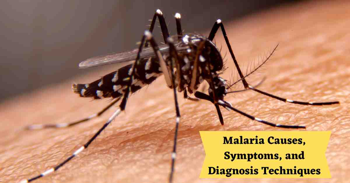 MarvelPathlab's tweet photo. 🔍 Explore Malaria: Causes, Symptoms, &amp; Advanced Diagnosis 🦟

Get the latest insights on malaria with our comprehensive guide. Learn about causes, symptoms, and the cutting-edge techniques used for diagnosis.

📝 Read Now

#Malaria #Health #MedicalBlog #MarvelPathLab https://t.co/1d3dyzxYTs