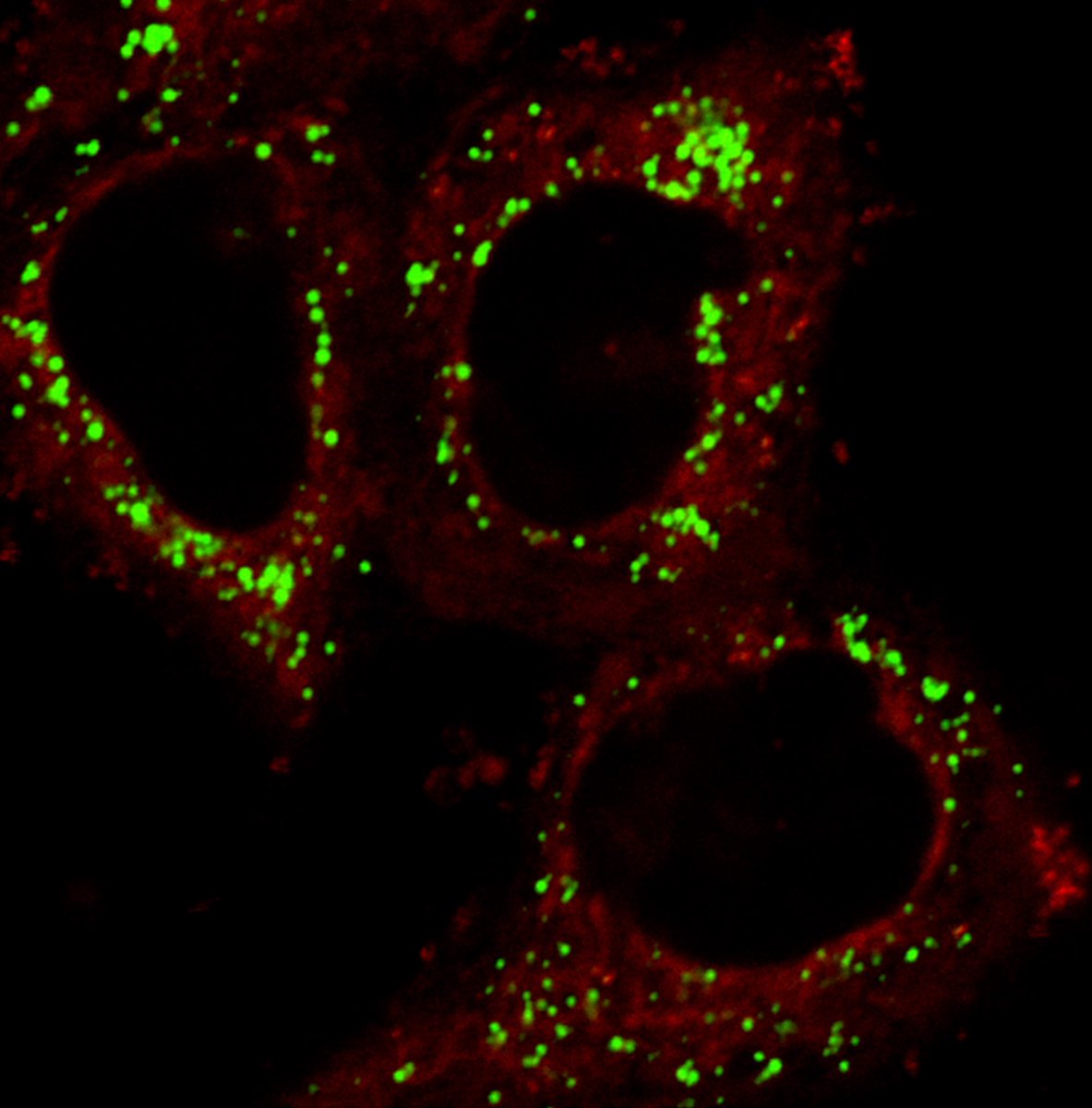 Two is better than one for organelles! Our latest work in Advanced Optical Materials shows how a fluorophore can target simultaneously lipid droplets and the endoplasmic reticulum, measuring micro-polarity during homeostasis and ferroptosis
doi.org/10.1002/adom.2…
 @AdvSciNews