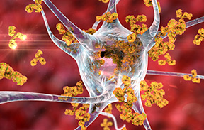 Our 3rd clinical series for 2024 is live: Multiple Sclerosis 2024.  

 It covers advances in MS across 4 key areas: epidemiological trends, MRI for disease management, fluid biomarkers, &amp; the impact of SARS-CoV-2 on MS.   

Explore these insights here👇
thelancet.com/series/multipl…