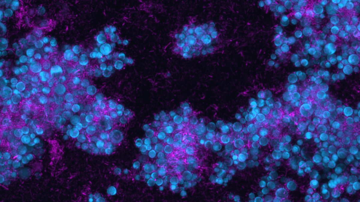 Giovanni Scarinci (@g_scarinci) on Twitter photo Excited to share this story now in <a href="/NatureComms/">Nature Communications</a> where we investigate the molecular mechanisms behind the evolution of enhanced metabolic "addiction" between microbial partners in a synthetic community. rdcu.be/dRIE5 Many thanks to <a href="/sourjik/">SourjikLab</a> for an amazing time in Marburg Excited to share this story now in <a href="/NatureComms/">Nature Communications</a> where we investigate the molecular mechanisms behind the evolution of enhanced metabolic "addiction" between microbial partners in a synthetic community. rdcu.be/dRIE5 Many thanks to <a href="/sourjik/">SourjikLab</a> for an amazing time in Marburg