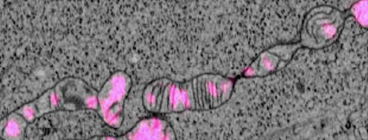 Suliana Manley 🔬🗜🧫 (@sulianamanley) on Twitter photo I’m excited to hang with this amazing community working at the cutting edge of in situ structural biology! Hope to see you there 😀. Will share fresh mito insights from <a href="/jclandoni/">Juan Cruz Landoni</a>, <a href="/LycasEats/">Matt Lycas</a> and <a href="/ZimmerliChris/">Christian Zimmerli</a>, collab with <a href="/WallaceUcsf/">Wallace Marshall</a>, <a href="/sturm_gav/">Gabriel (Gav) Sturm</a>, <a href="/cjobara/">Christopher Obara</a> <a href="/aaandmoore/">Andy Moore</a>, <a href="/JLS_Lab/">Lippincott-Schwartz Lab</a> I’m excited to hang with this amazing community working at the cutting edge of in situ structural biology! Hope to see you there 😀. Will share fresh mito insights from <a href="/jclandoni/">Juan Cruz Landoni</a>, <a href="/LycasEats/">Matt Lycas</a> and <a href="/ZimmerliChris/">Christian Zimmerli</a>, collab with <a href="/WallaceUcsf/">Wallace Marshall</a>, <a href="/sturm_gav/">Gabriel (Gav) Sturm</a>, <a href="/cjobara/">Christopher Obara</a> <a href="/aaandmoore/">Andy Moore</a>, <a href="/JLS_Lab/">Lippincott-Schwartz Lab</a>