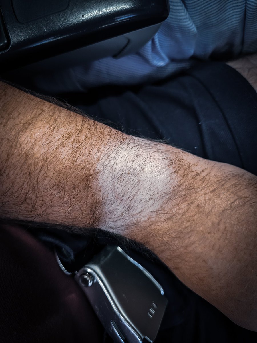 gettingoutout's tweet photo. When @GarminUK data is life, you even sacrifice the tan lines on holiday!

#dodgytan #garmin #holiday https://t.co/aR5Tou2LGh