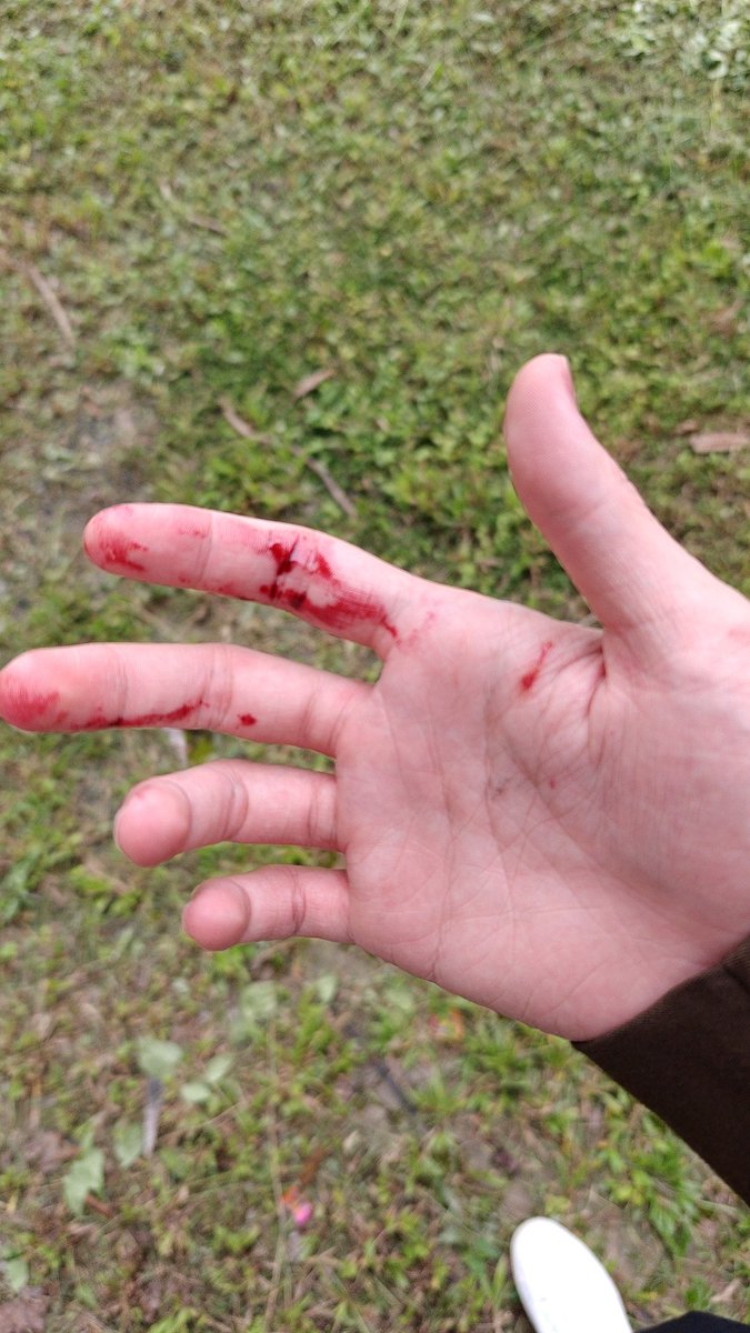 LeeThanapob's tweet image. เพิ่มเติม #การุณยฆาต วันนี้

ของจริงหรือของปลอมให้ทาย
ไอ้หยาาาาา🥹😅

#thanapob_lee