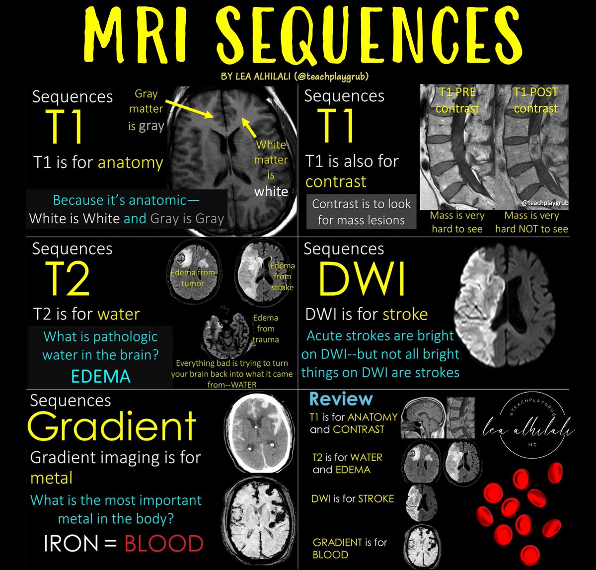 If you aren’t cheating, you aren’t trying!

Are you looking at MRIs?

Feeling some confusion about the diffusion?

Feel impaired when it comes to the FLAIR?

Wish you could cheat a little?

Here’s a little cheat sheet on all the sequences you NEED to know if you are looking at