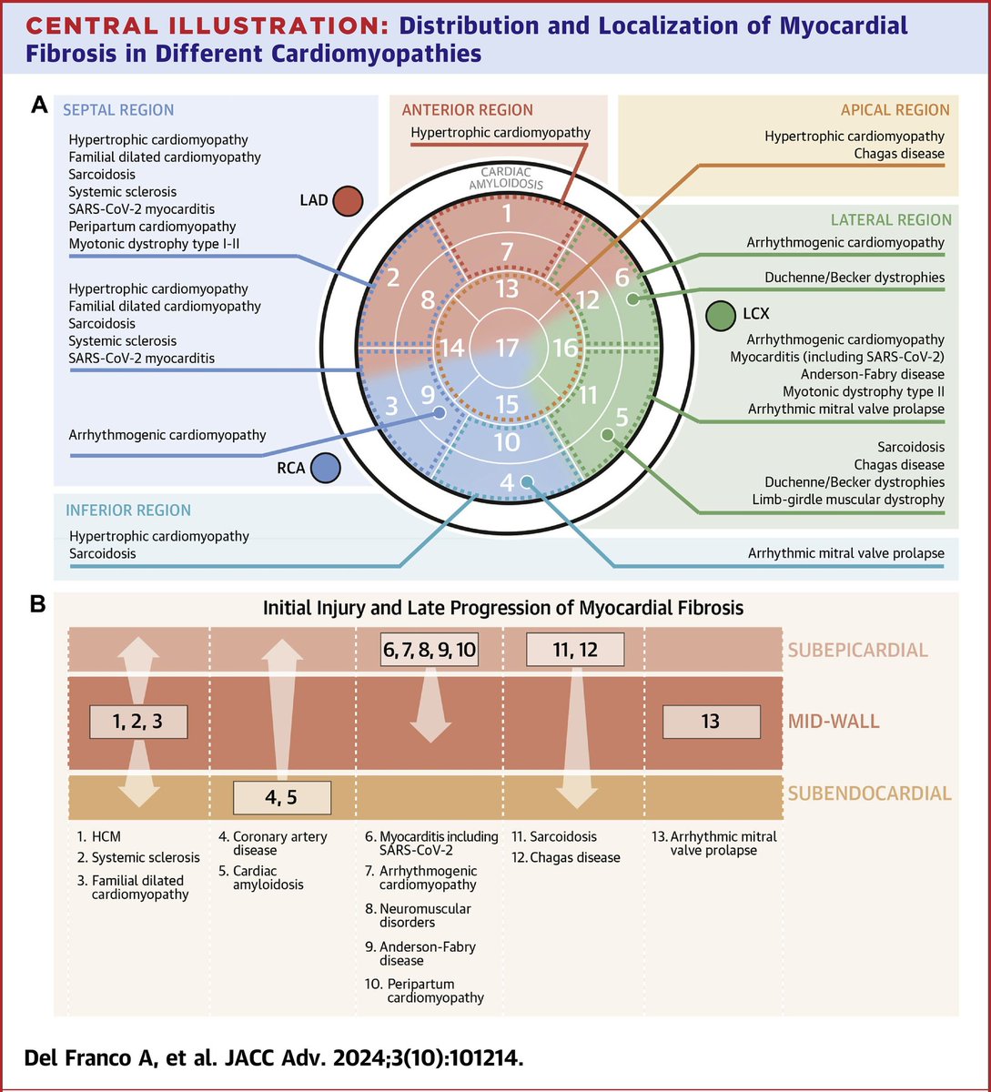 🔴Atlas of Regional Left Ventricular Scar in Nonischemic Cardiomyopathies: Substrates and Etiologies⤵️State-of-the-Art #2024Review #OpenAccess

🔹sciencedirect.com/science/articl…
 #FOAMed #MedEd #medstudent #paramedic #Cardiology #CardioEd #medtwitter #meded #CardioTwitter