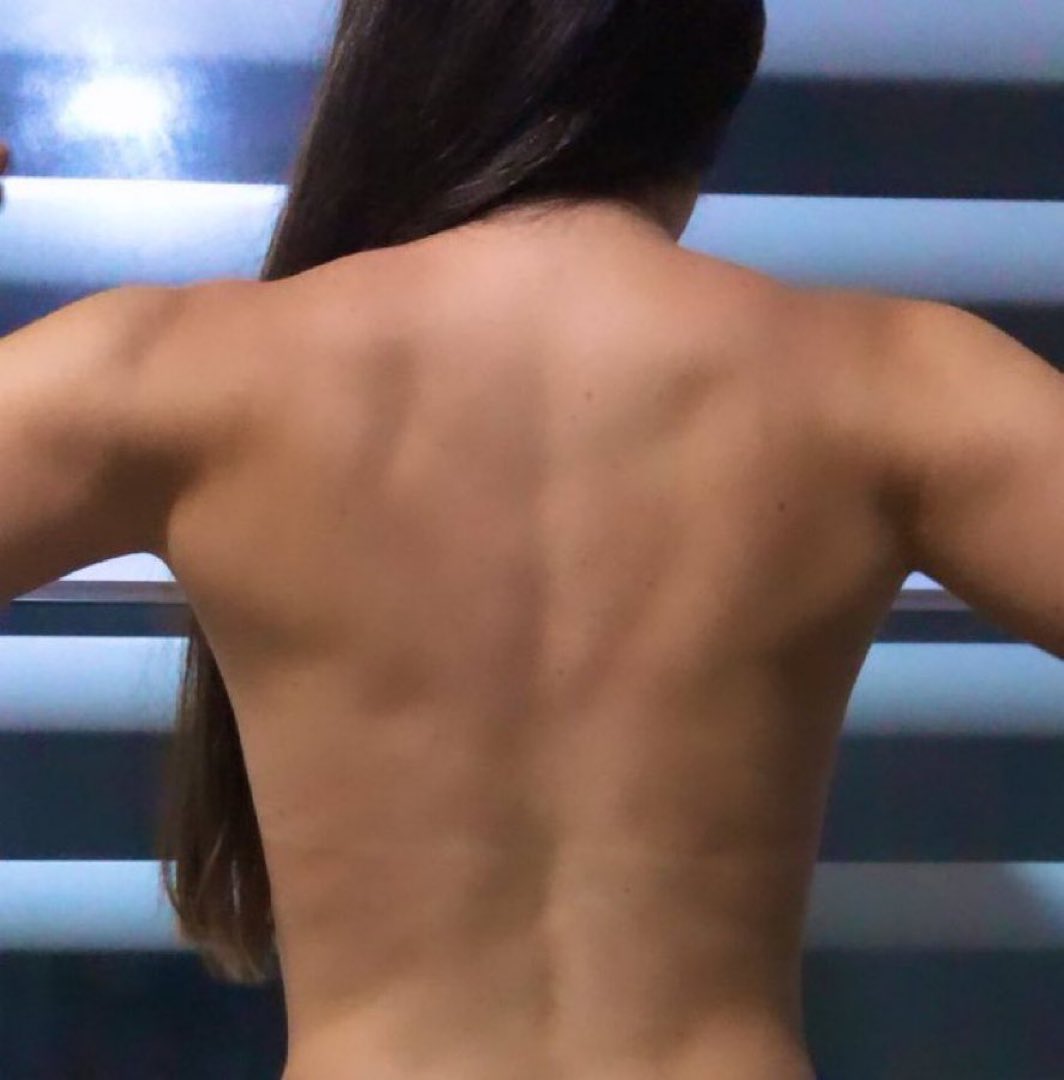 ¿Hasta donde llega el fanatismo?

Esta mujer se tatuó en su espalda las actas que muestran la victoria de Nicolás Maduro.