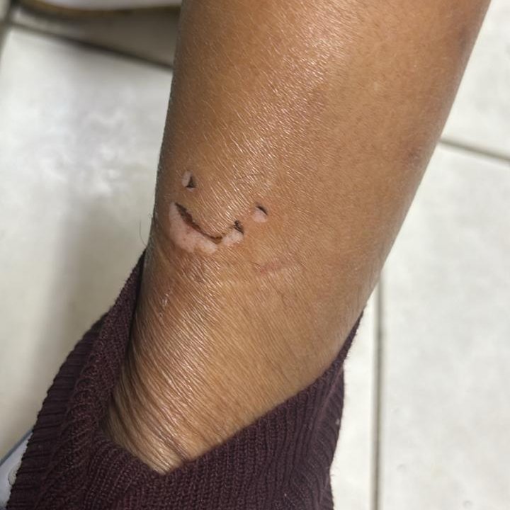 REVOLTANTE! 😡

Ontem à tarde, o artesão Vanderlei Soares foi acusado de roubo e covardemente agredido por um segurança do supermercado Hoffmann, na Vila Nova, zona sul de Porto Alegre. 

Ao lado da família do Vanderlei, me somo na convocação de um ato contra o racismo amanhã.