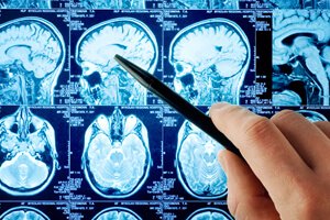 centracare_mn's tweet photo. 🎉 Exciting news! CentraCare Neurosciences Stroke Center has received two prestigious recognitions for providing exceptional stroke care in Central Minnesota! https://t.co/ldB6tHwQrg https://t.co/8absiiWE1b