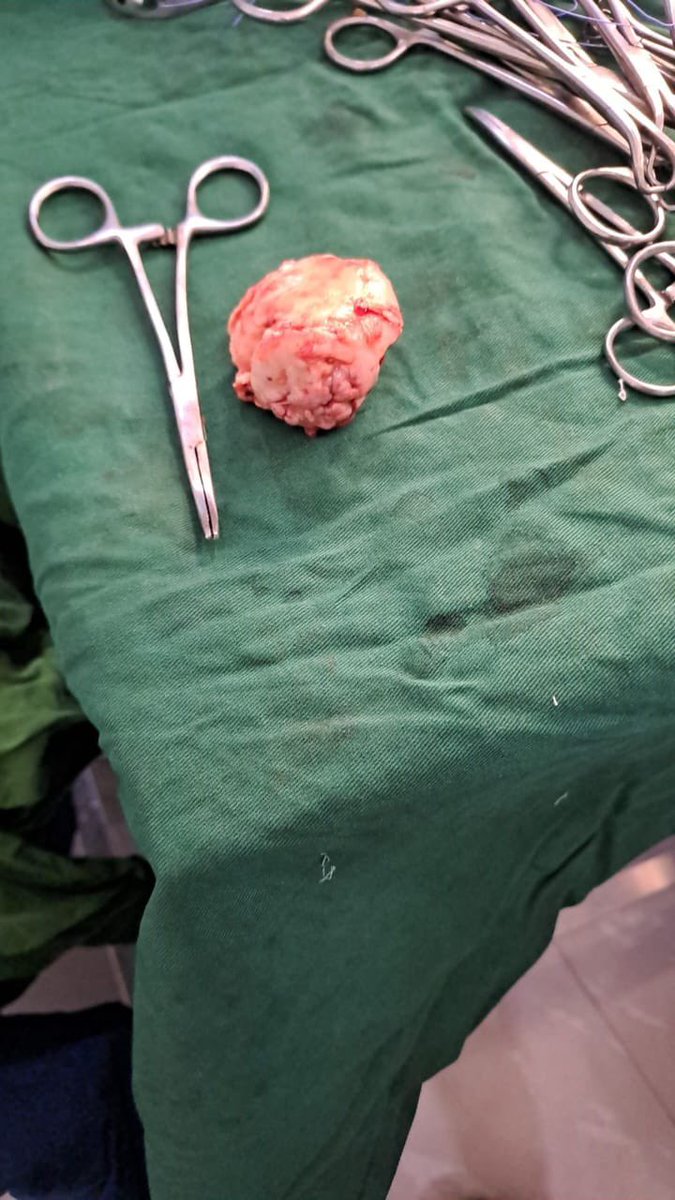 bornohmb's tweet photo. Photos: The first successful total hip replacement  in a sickle cell  disease patient at State Specialist Hospital Maiduguri.
Well done Dr Ramat https://t.co/FMGowk9r9S