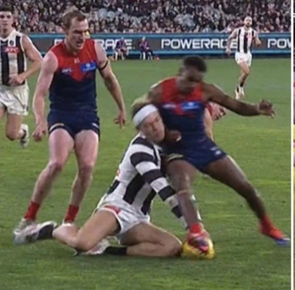 Argument 1:
If Moore keeps his feet then there is no high contact. No case to answer. 

Argument 2: 
You choose to bump and concuss the player regardless of how, that’s 5 weeks.

Argument 3:
See argument 2, but a 2-3 week penalty as he plays for a Victorian club. 

#aflpiesdees