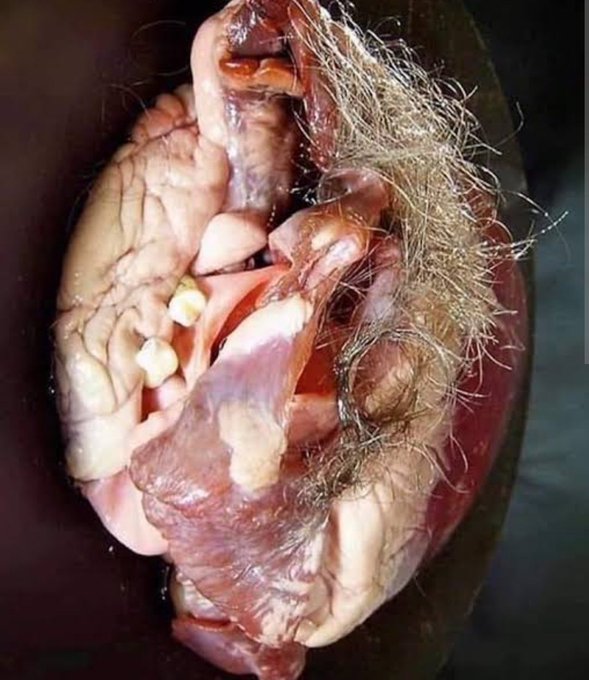 &iquest;Que pasa si un teratoma crece con un conjunto de neuronas? Es probable  que el sistema inmune detect&eacute;<a href="/tag/cosplay"class="tags"><span>#cosplay</span></a><a href="/tag/underwear"class="tags"><span>#underwear</span></a><a href="/tag/colegiala"class="tags"><span>#colegiala</span></a><a href="/tag/sexi"class="tags"><span>#sexi</span></a><a href="/tag/seifuku"class="tags"><span>#seifuku</span></a>