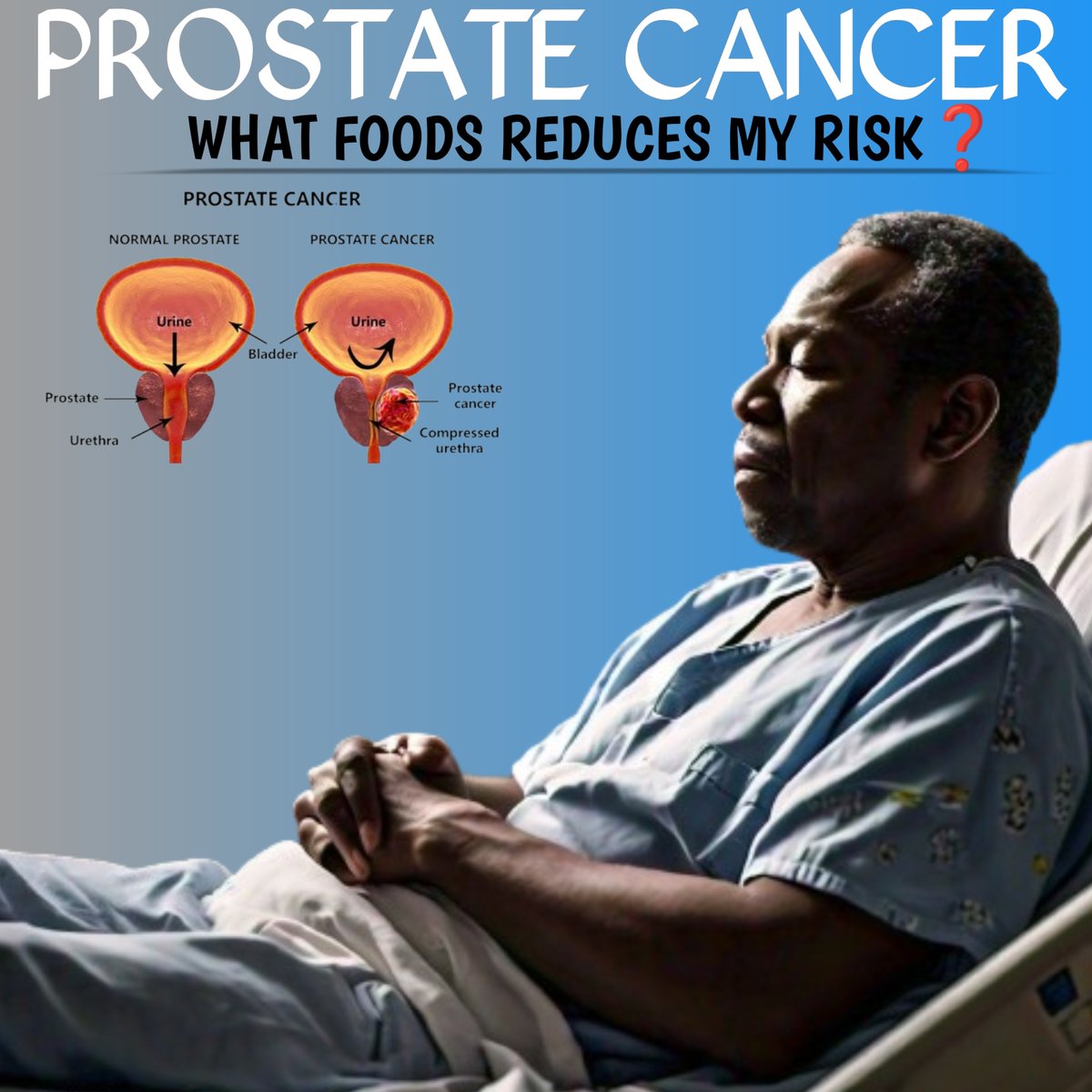 Prostate cancer is the 2nd most common cancer in men worldwide (after lung cancer).

WHO IS AT RISK OF PROSTATE CANCER❓

"Let the food be thy medicine and let medicine be thy food".

WHAT FOODS SHOULD I EAT ❓

WHAT FOODS SHOULD I AVOID ❓

A THREAD👇