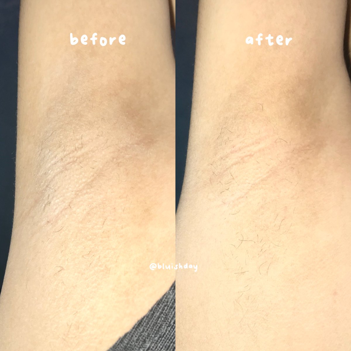 dinda ꣑ৎ tweet media