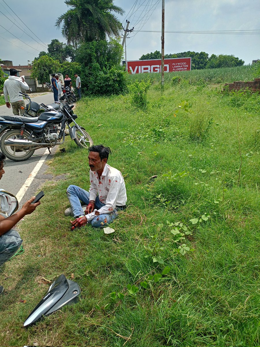 AdvAnkushpal1's tweet photo. #uppolice अभी सड़क दुर्घटना में एक बाइक सवार व्यक्ति की घायल हो गया उसकी हालत बहुत नाजुक बनी हुईहै पुलिस सहायता हेतू 112 और एम्बुलेंस 108 को कॉल किया गया लेकिन 1 घंटे तक कोई सहायता नही मिली अगर उसकी मौत होती है इस बात का जिम्मेदार कौन होगा #YogiAditynath #DMMEERUT https://t.co/KEMA9fmfdL