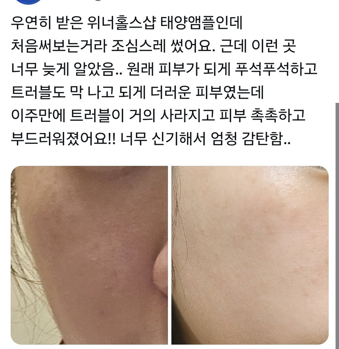manduuiilsang's tweet photo. 태양앰플 써보실 분들을 구합니당
무료나눔이구요 알티추첨 드립니다!
안히 분명 타파가 저 기능을 하는데....
태양이가 기능 혼자 다해버려서 큰일...

5분 구합니당 알티만 해주세요! https://t.co/Xe49g6Ewkw