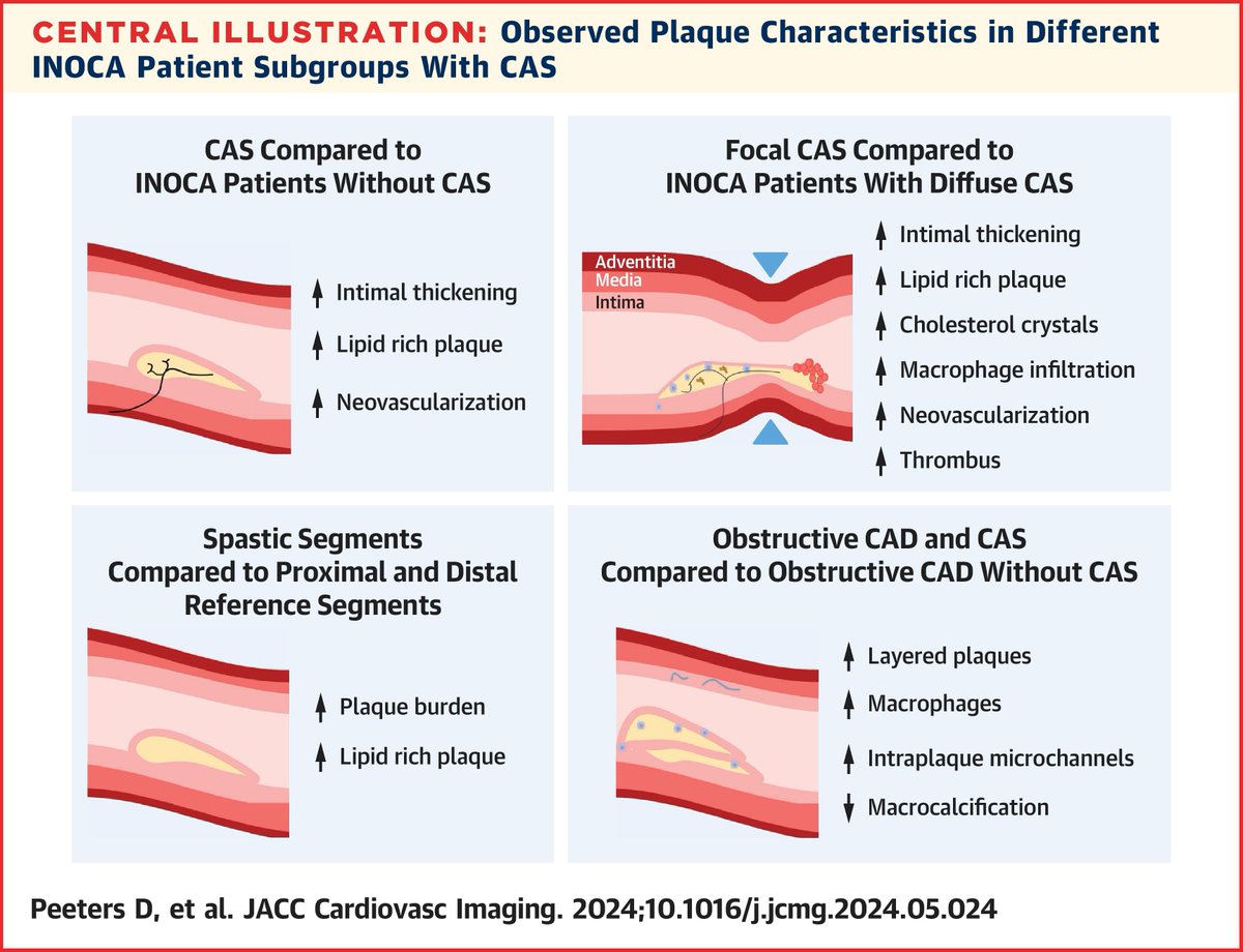 Interesting article on the association between coronary artery spasm and atherosclerosis: jacc.org/doi/10.1016/j.…

Our accompanying editorial available here: jacc.org/doi/10.1016/j.…

<a href="/BernardBruyne/">Bernard De Bruyne</a> <a href="/JACCJournals/">JACC Journals</a>