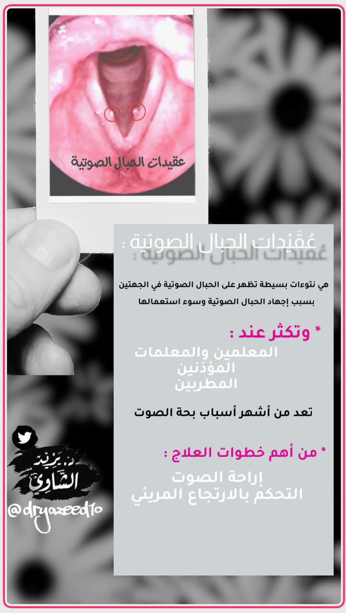 ✔️احد اهم اسباب بحة #الصوت .. وتكثر عند #المعلمين و المؤذنين