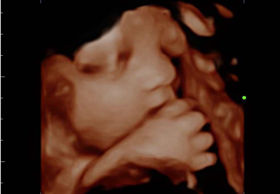 jaysfighttalk's tweet image. @Turki_alalshikh @boxxer @EddieHearn my grandson has the #phillyshell in the womb! I’m negotiating his #RiyadhSeason 2044 debut #boxing