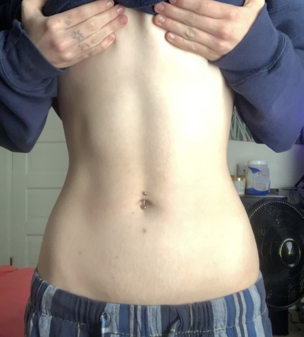 DietCoke0bs's tweet photo. what 9 months can do for ya

(-40 lbs) https://t.co/TM5FsknwcC