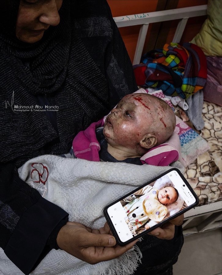 BEFORE AND AFTER

ENOUGH IS ENOUGH