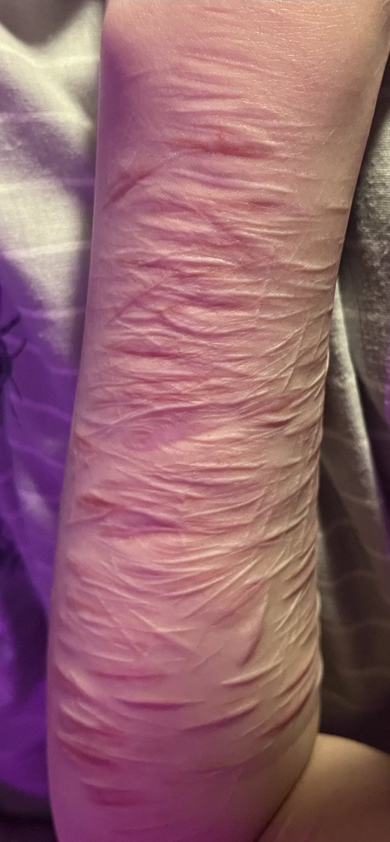 ༺ 𝖊𝖈𝖑⛥𝖕𝖘𝖊 ༻ tweet media