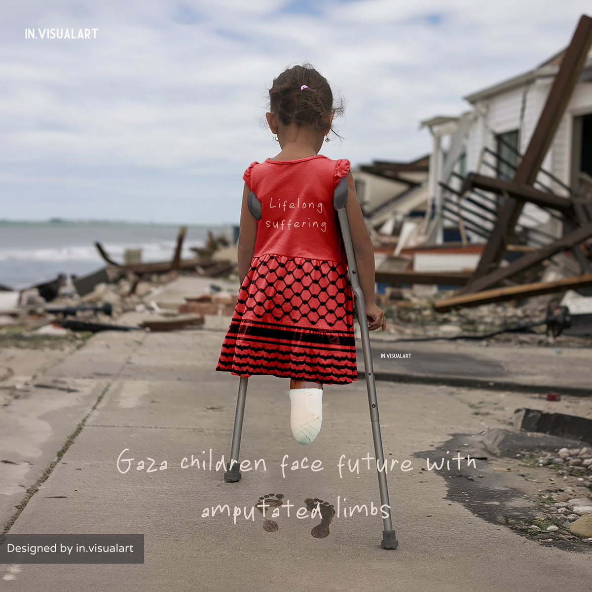 in_visualart's tweet image. Gaza children face future 
with amputated limbs 
“Rahaf Saad had both lower limbs amputated in an Israeli bombardment of her home west of Nuseirat in the central Gaza Strip”#freepalestine #savegaza #trending #save_gaza #flowers #freedom #gaza #viral #fyp #islam #prayer #me #cute
