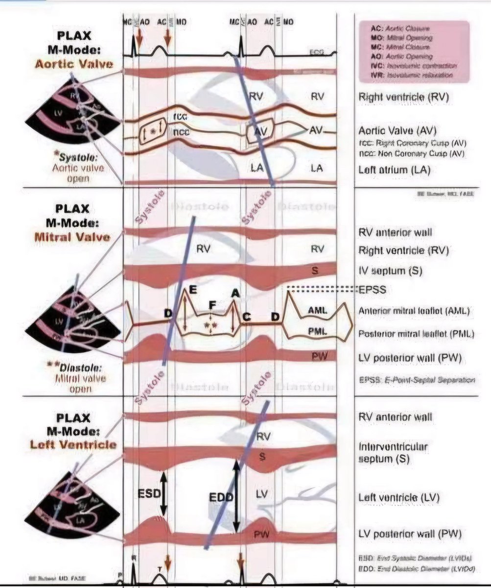 🔴BASIC ECHOCARDIOGRAPHY⤵️
    🔹Standard Views
   🔹Guidelines for Chamber Quantification
 #FOAMed #MedEd #medstudent #paramedic #Cardiology #CardioEd #medtwitter #meded #CardioTwitter #cardiotwiteros  #MedX #cardiovascular #MedTwitter #medical #medEd #cardiotwitter